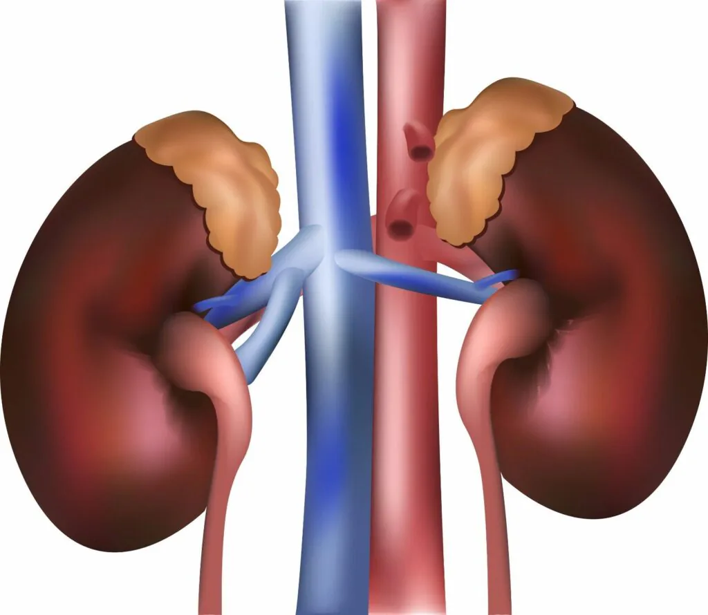 cisto renal
